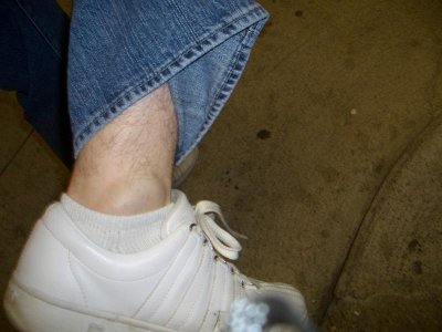 my ankle 002 revised.JPG