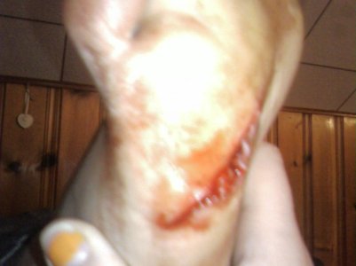foot.jpg