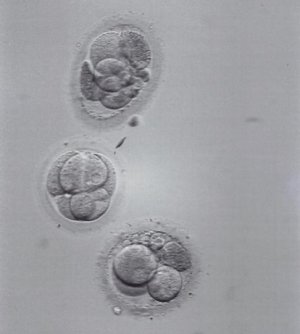 New Embryos-3-17-2009 3;06;42 PM.small.jpg