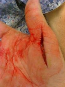 my cut hand.jpg