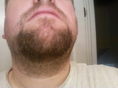 rsz_chin_hair.jpg