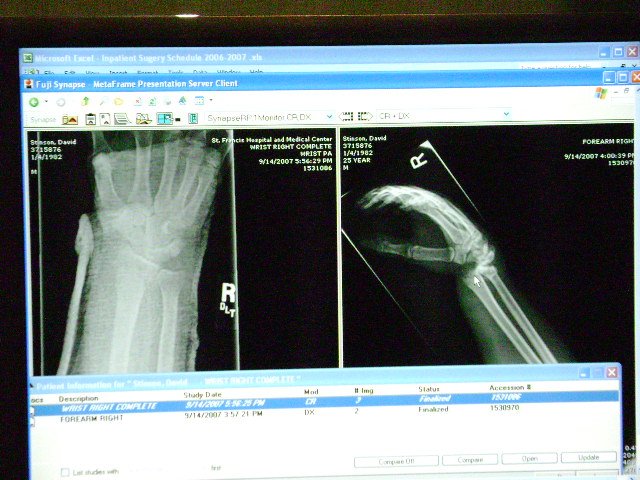 xray1.jpg